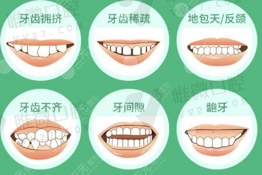 临*全口义齿非常常用的牙合架（全口义齿的牙合型为）(图1)